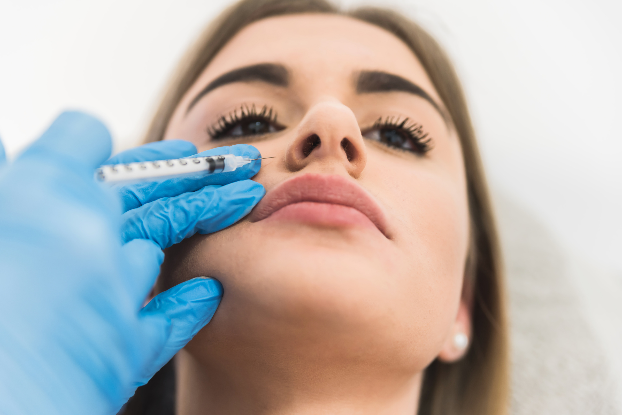 Woman having fillers on gummy smile area